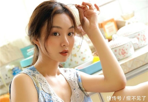 嘴周长痘要注意哪三个方面呢?痘博士简单说说!