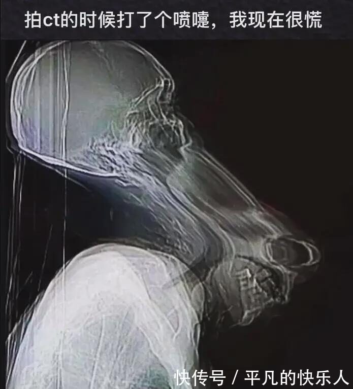 |今日段子:竟然还有人反向烤火?难道不怕烧到屁股吗?