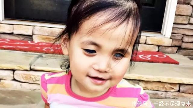 收养|天生“蓝眼睛”被抛弃的中国女孩,被美国夫妇收养后,改变了人生