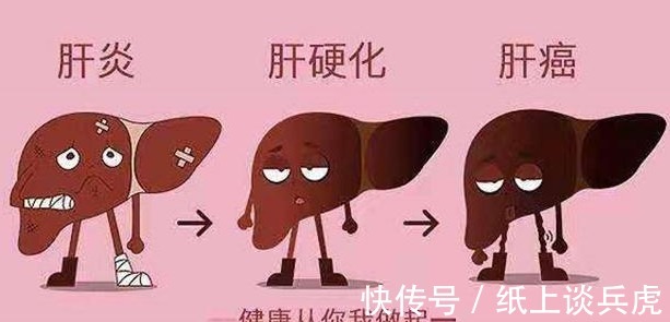 生存期|“不要抢救我”!65岁老人肝癌晚期拒绝手术化疗,带着尊严离去