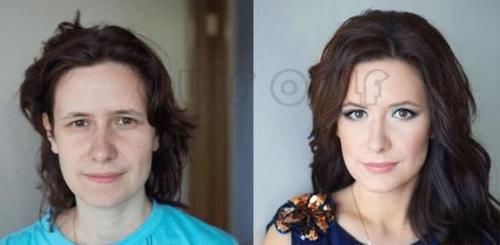 全脸埋线多久恢复自然、线雕恢复期是多久