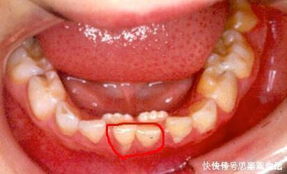 孩子|送给孩子正在换牙的父母们,你们一直都做错了什么?