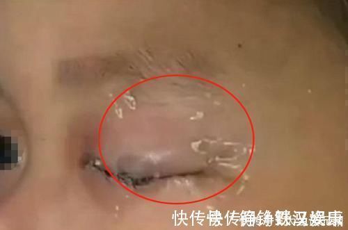 零件|儿子误将502滴入眼中,爸爸“教科书式”方法救了孩子,医生:高明