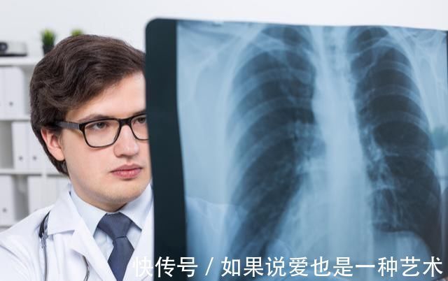 肺癌|25岁小伙反复咳嗽，3月后去世，医生：只因他拒绝这项普通检查