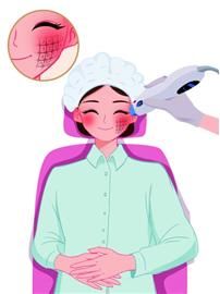 杏仁酸|自己动手“刷酸”？小心毁容