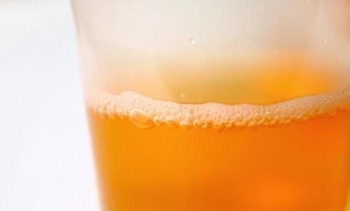 糖尿病|糖尿病人泡沫尿时有时无,是什么原因?本文为你说清