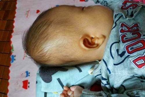 堪比|“睡扁头”的畸形美，堪比古代的“裹脚”，能放过孩子的头吗？