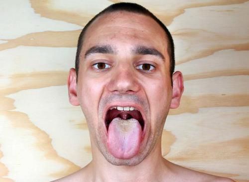  补脾|脾虚的六大典型症状，你有几个？若超过两个，你该“补脾”了