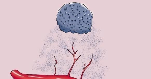 疾病|查出肺癌晚期,却能带瘤生存13年,抗癌心得有4个,或可以借鉴
