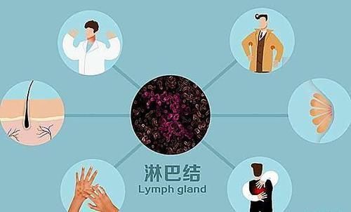 淋巴结肿大|淋巴结肿大不是淋巴癌的唯一症状,得了淋巴癌,还会有哪些异常