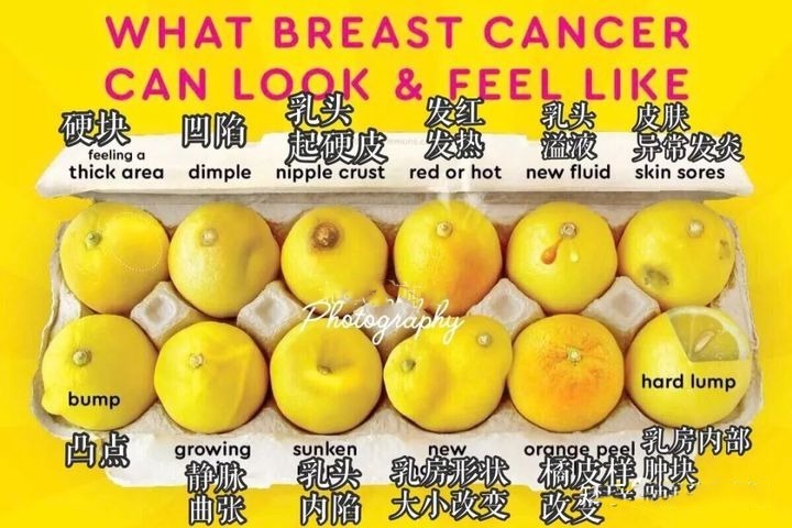中国抗癌协会|TAA Medical统恩医学专家提醒乳腺癌发病率又变高了,预防要趁早