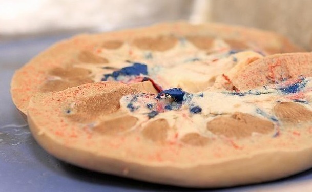 血糖|身患“糖尿病”的人,表现都很明显,为健康别再傻傻忽视