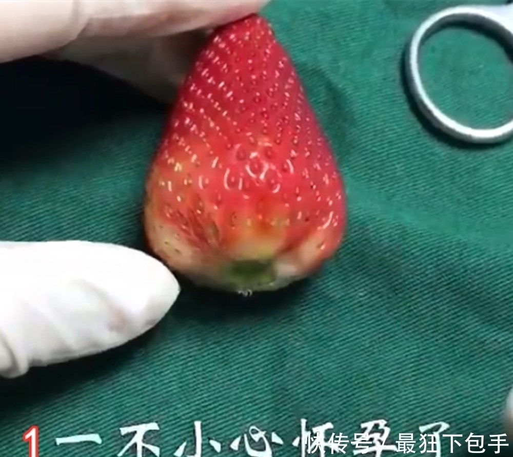 夫妻|人流对女性伤害有多大?看完这组“草莓”模拟图,夫妻决定避孕