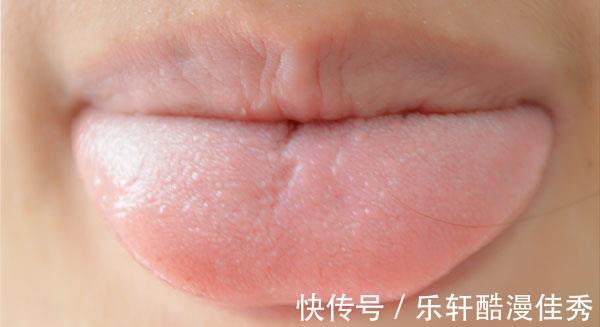 食物|孩子总积食，是不是吃面食的缘故建议少吃4种食物