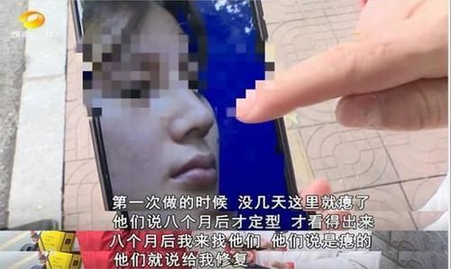 女子花60000整容,术后却整成“凹陷鼻”,找其理论主刀医生闭门不见