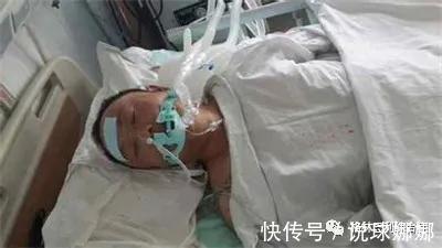 特点|格林巴利综合征早期发病特点