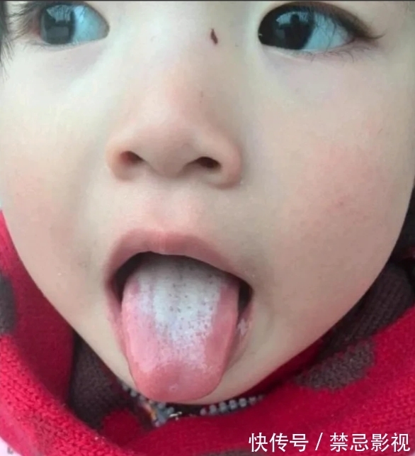 脾虚|发现没:孩子有这样的舌苔,是很难长肉长高的