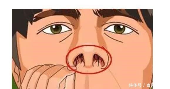 鼻毛|为什么鼻毛会窜出来鼻毛过于茂盛暗示什么