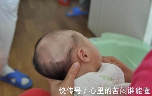 满月头|婆婆带宝宝去剃满月头，几个月后孩子成了这样，医生怒斥家属无知