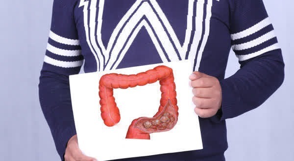 筛查|哪些原因容易导致癌症复发?医生在文中一一列出,帮大家预防