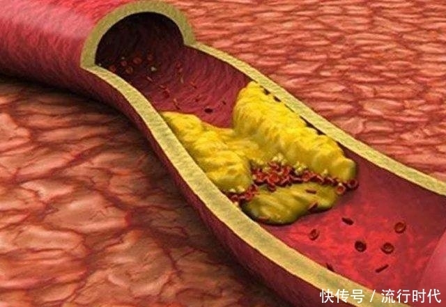 越来越|有种食物每天吃几个好处多多,防血栓、抗衰老、身体越来越健康