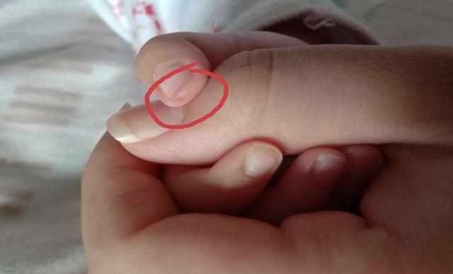 家娃|孩子聪明不聪明,从手上这些特征就能看出,快看看你家娃有吗