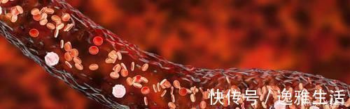 玉桑清茶|血液粘稠，易突发栓塞，1个“秘诀”疏通血管，把血管“洗”干净