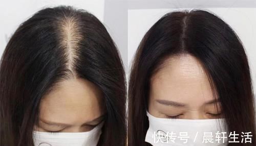 头发|女性40岁后多喝“护发汤”，好吃不贵，乌黑秀发，头发不再大把掉