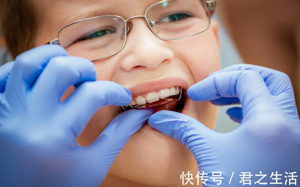 矫治|儿童做牙齿矫正三个最佳时间:家长要牢记,矫治越早干预效果越好
