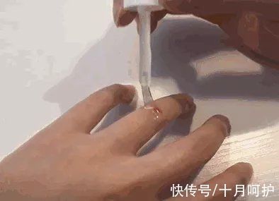 残疾|三岁女童被活活截断手指,终生残疾!只因用错创可贴,快自查