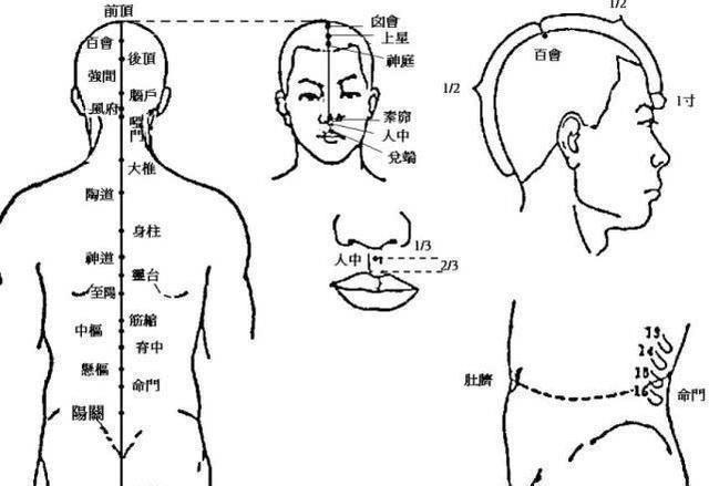 奇穴妙用(五)人中、委中穴-急性腰痛特效穴