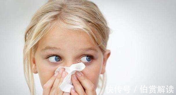 孩子|2岁宝宝经常挠头,频繁洗头也不见缓解,送医后医生摇头来晚了