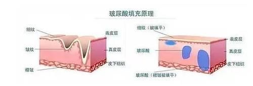 解救“大龄”眼周问题，这篇给你一次搞定