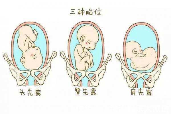 医生|顺产宝宝和剖腹产宝宝有啥不一样这三处不同,医生一般不对外讲