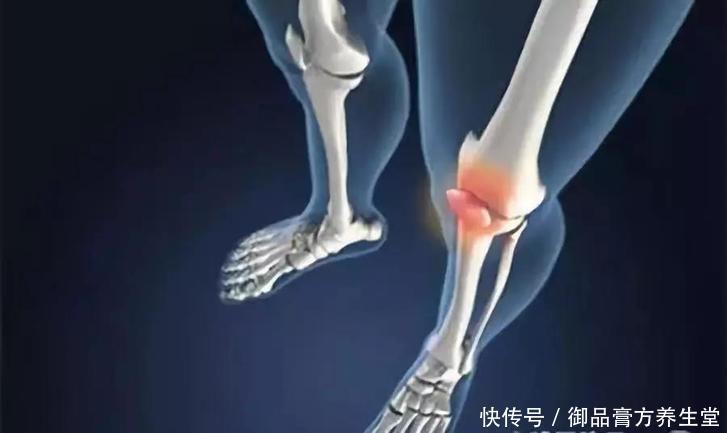 寒湿|六月已至,冬病夏治迅猛除根,不知道就亏了