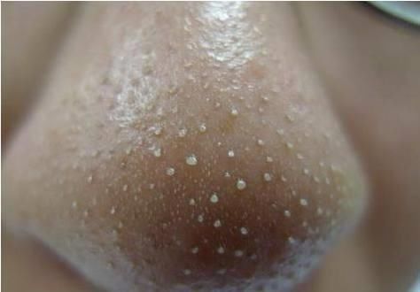 肝脏|它们是“天然护肝王”，每天来两颗，肝病不来找