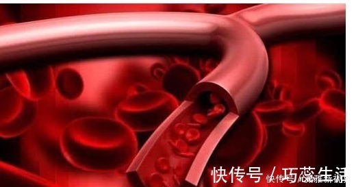 含有|血液粘稠的“稀释药”找到了,每天吃一点,净化血液,血栓不来扰