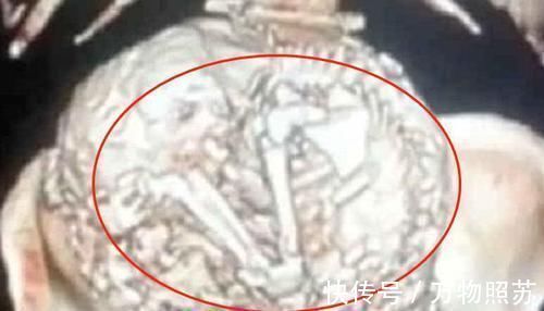 钉子户|91岁老人意外发现怀孕,“孩子”在肚中已待61年,网友钉子户