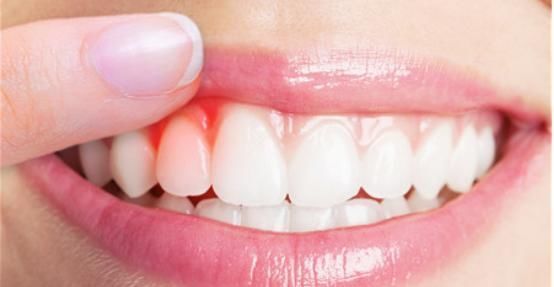 方法|得了口腔溃疡特别难受医生教你3个方法,迅速痊愈,胃口大开