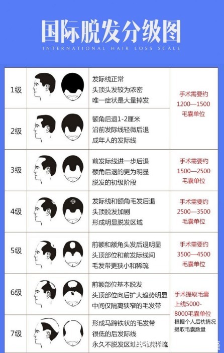 种植 植发一般需要多少钱，种植发际线一万元够吗？