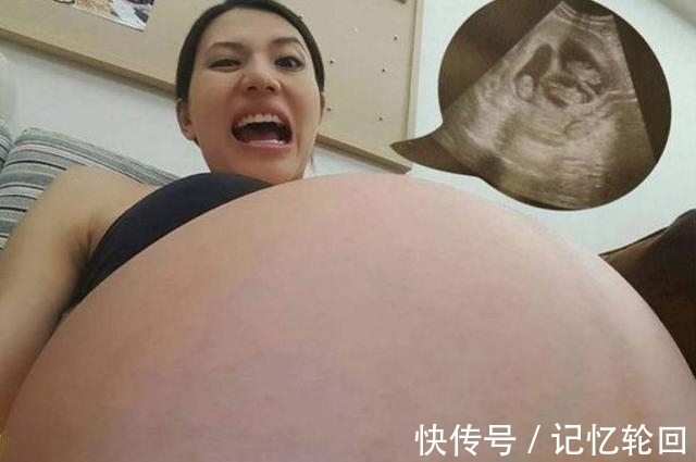 孕妇|孕妇生下宝宝,护士出来报喜,家人看到孩子数量后,全家人懵圈了