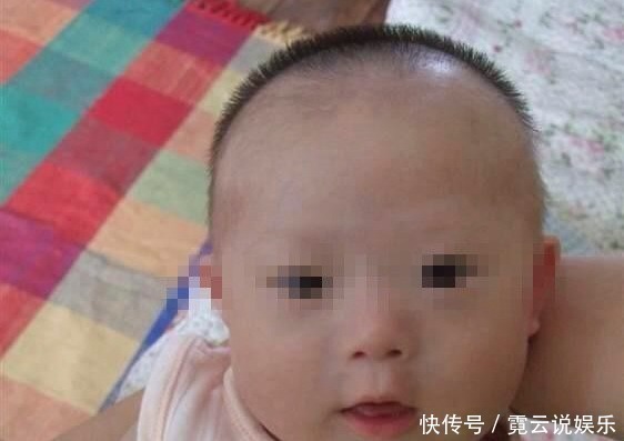 “唐氏宝宝”逐年多起来，多半是父母造成的，3种孕妈妈要小心！