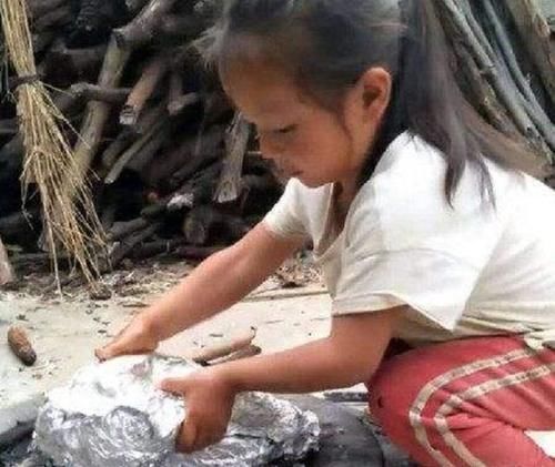 木质类|6岁女童得怪病突然暴瘦,检查后医生让摘项链,妈妈:哪里有项链