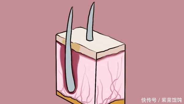 鼻毛“窜”出鼻孔说明什么?该剪还是该拔?建议您看完再决定