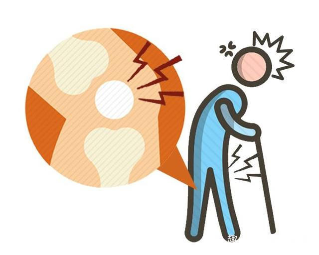 有氧操|骨质疏松,别等50岁才后知后觉!提醒3种补钙的方法,靠谱!