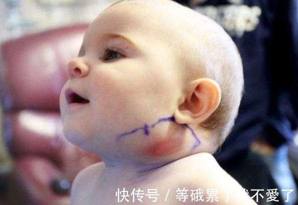 bober|女孩哭喊着挠脖子,到医院取出来的东西,全场人情绪失控