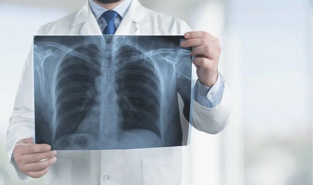 磨玻璃结节|体检查出肺结节,是癌吗?医生:害怕肺癌,先看这2件事做对了没