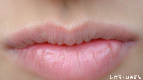 脾虚|你的脾虚不虚,看脸就知道健脾只需一个小方子