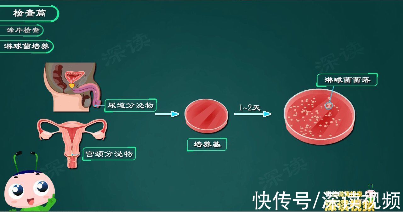 抗生素|得了淋病遭罪不说,还易复发,该咋办?快看看你的药都用对了吗?