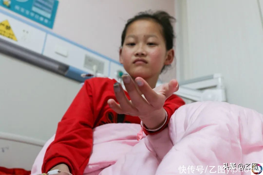 第一附属医院|花季少女患一种怪病，手脚从指头开始碳化，检查结果让父母崩溃